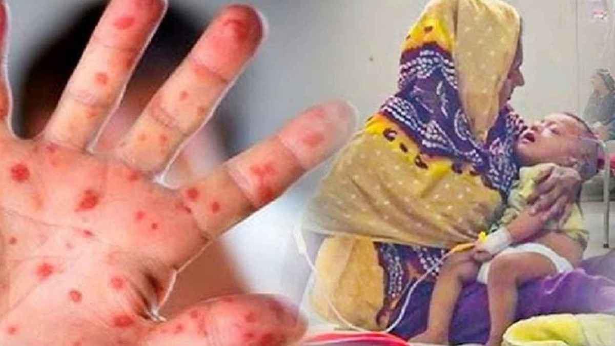 - ছবি - ইন্টারনেট